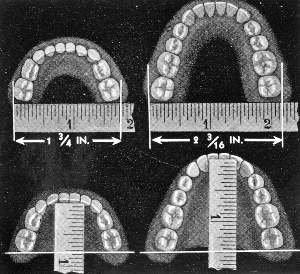 /Dental Diagram, Copied for Health Department — illustrating best cancer heart stroke insurance